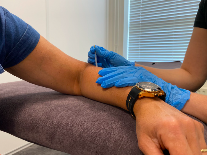 Fysiotherapeut behandelt iemand met een tennisarm